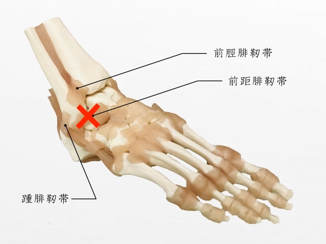 足の関節