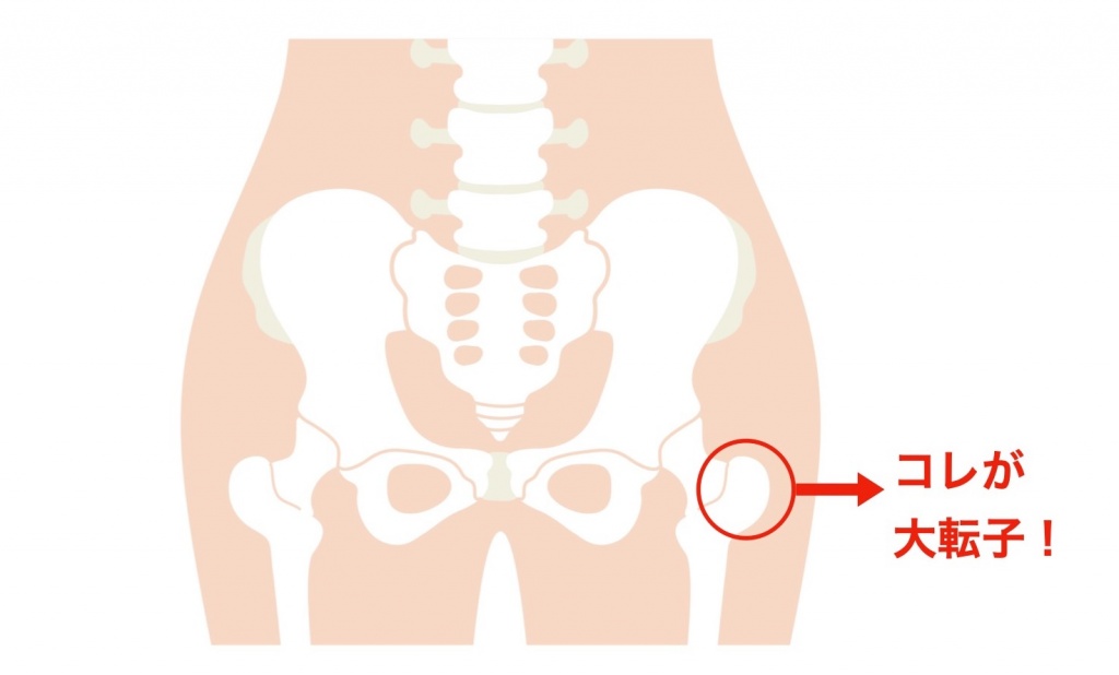 太もも痩せに一番効果的なのは 股関節 大転子 を引っ込める事です 大阪本町の骨盤矯正と猫背矯正整体 Uenishi整体院