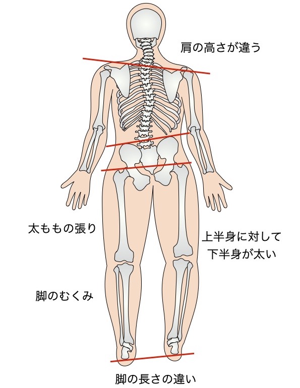 歪みによる体型の変化