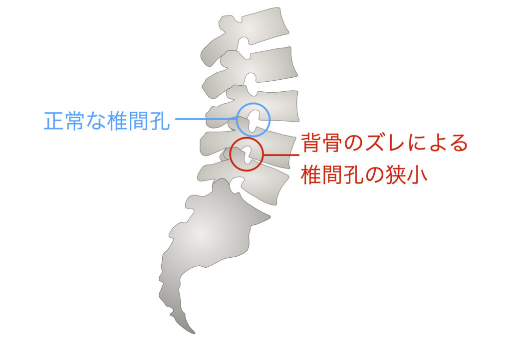 腰を反ると痛い腰痛。その原因と対処法について | Uenishi整体院｜大阪本町・吹田江坂の本格カイロプラクティック