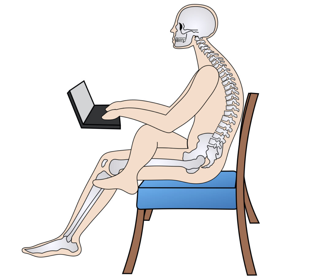 猫背姿勢の生活習慣