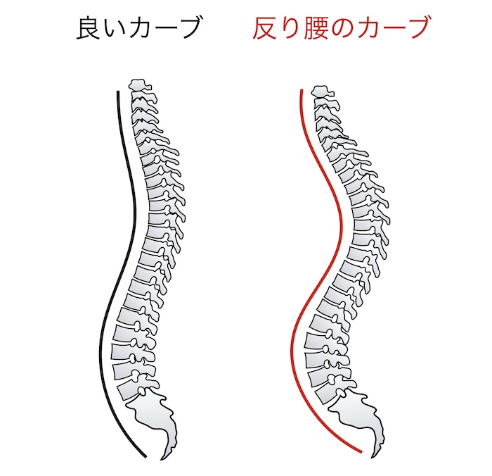 脊柱カーブ比較