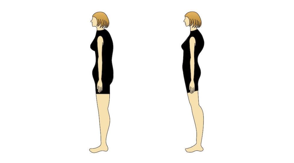 猫背姿勢のタイプ