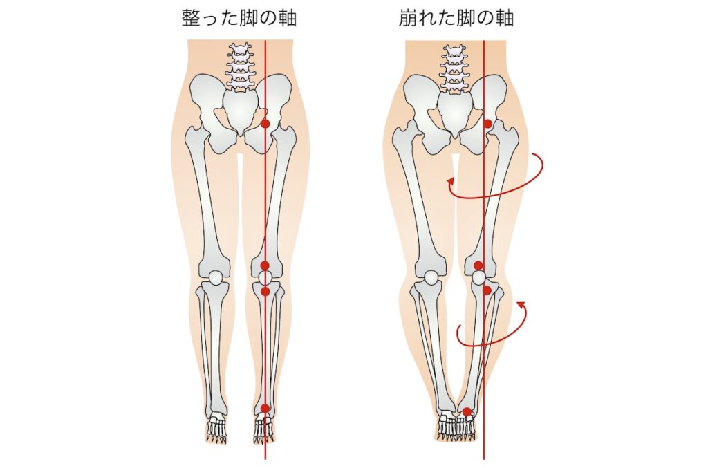 足の軸の比較
