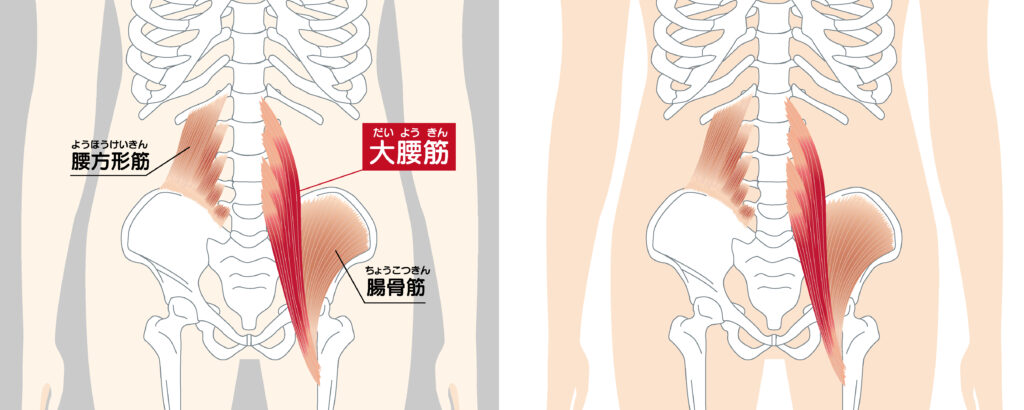 腰方形筋