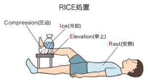 RICE処置