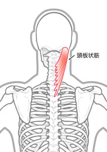 頭板状筋