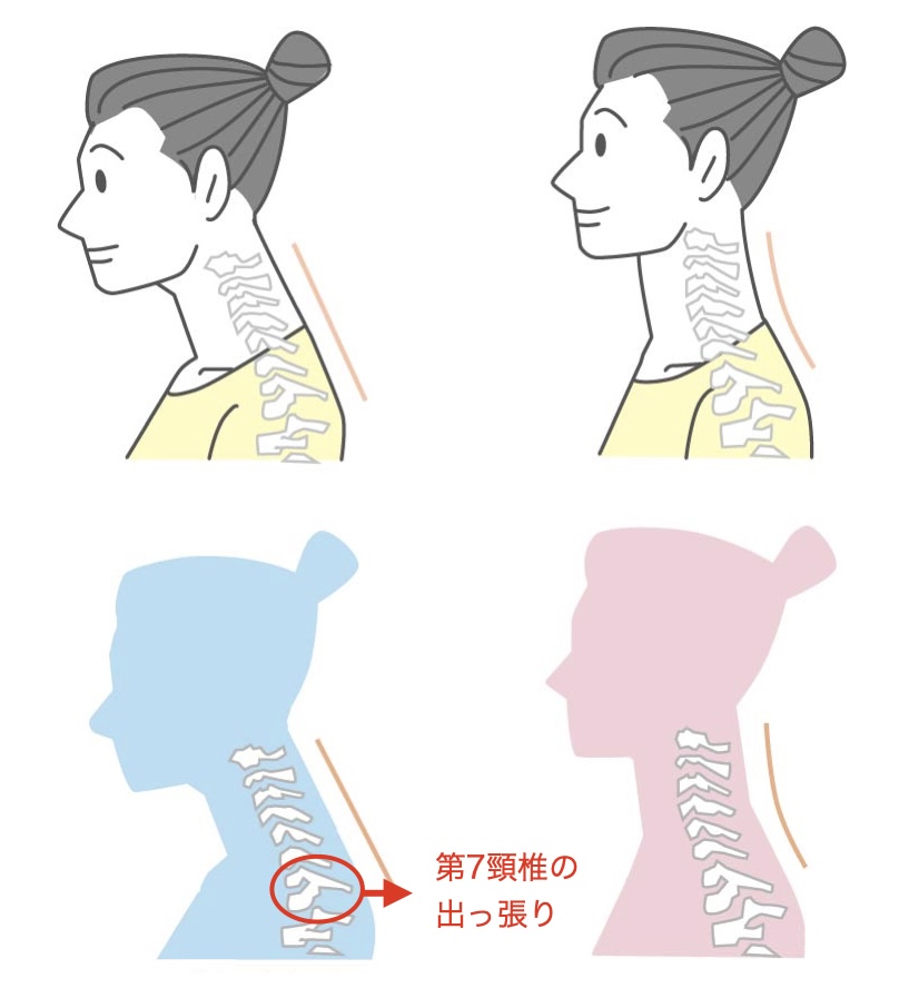 頭の位置の比較